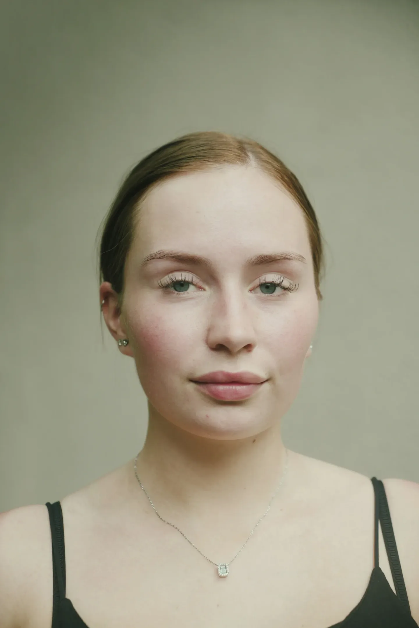 Understanding Your Skin Barrier: How to Protect and Restore It